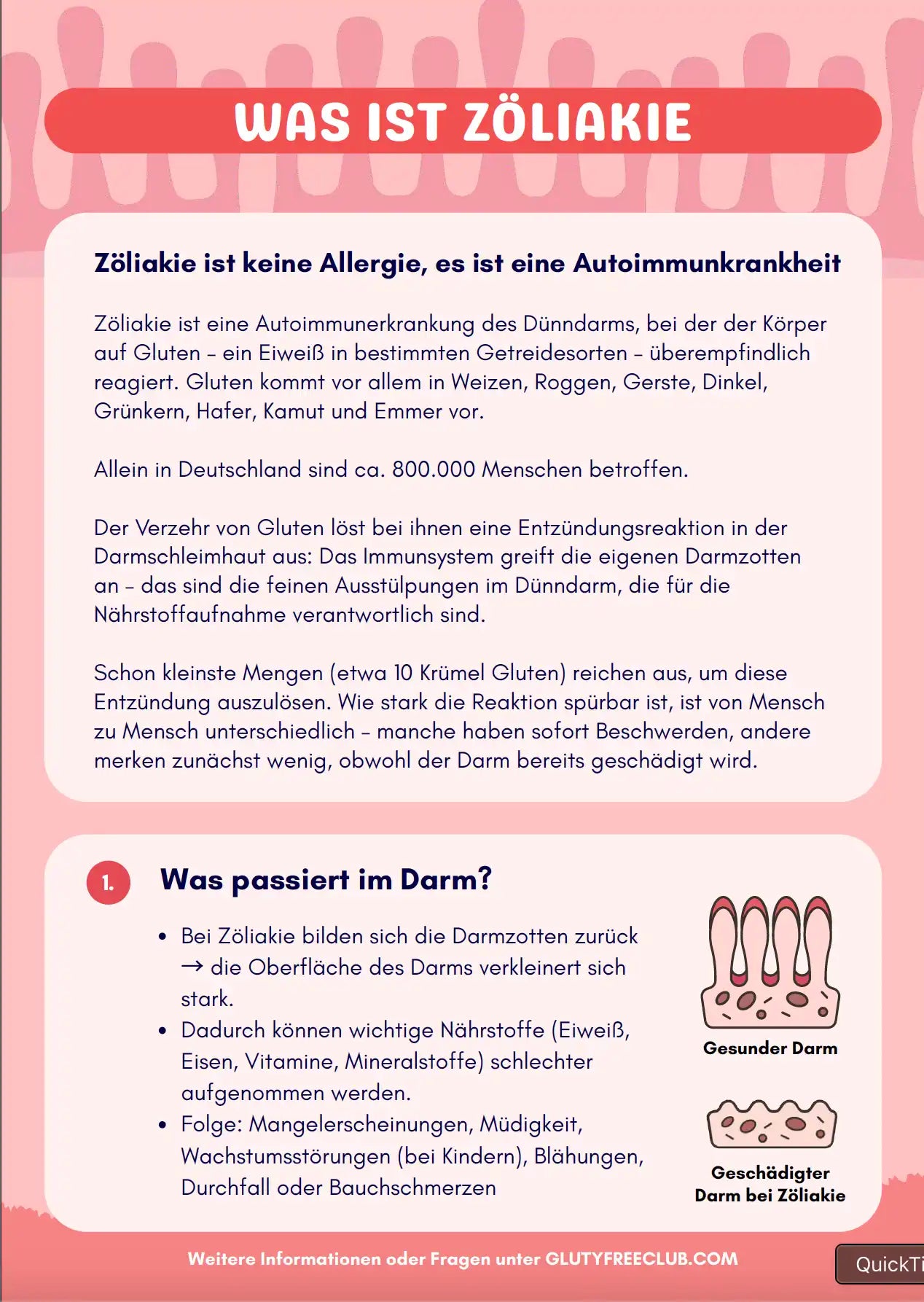 Zöliakie Flyer, 5-seitig, Was ist Zöliakie, Handout, Druckbares PDF